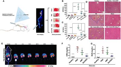 Reactive Oxygen Species (ROS)-Responsive Nanomedicine for Solving Ischemia-Reperfusion Injury